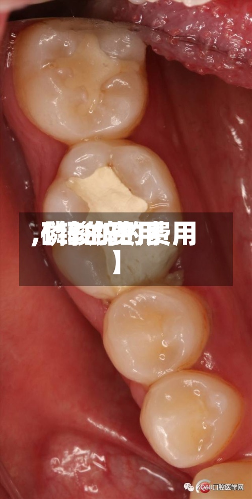 【锌的费用,磷酸锌的费用】